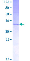 12.5% SDS-PAGE Stained with Coomassie Blue